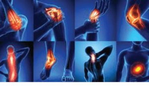 Essential things to know about joint pains